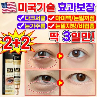 아이비크림