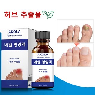 [휴일에도 정상 발송합니다] 문제성 손발톱 전용 앰플 영양액 발톱 강화 및 종합적인 손발톱 케어, 2개, 10ml