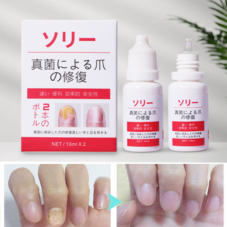 [100% 정품 보증] 일본 손발톱세럼 발톱 무좀 손톱 영양제 발무좀약 발톱연화 조갑사상균증 살균, 4개, 10ml