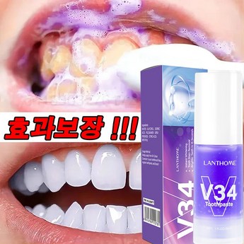 치아미백제브러쉬-추천-상품