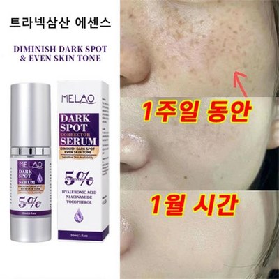 트라넥삼산 크림 트라넥삼산 에센스 미백 기미 제거 세월 흔적 지우기, 3개, 30ml