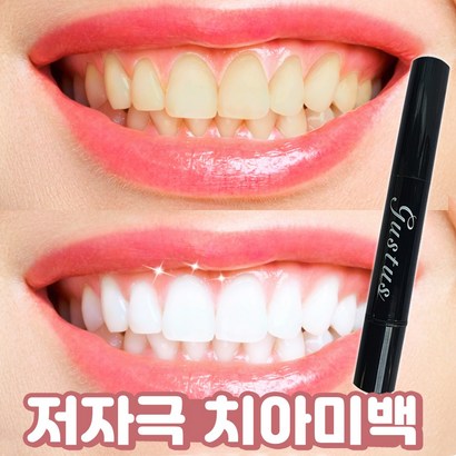 치아미백 셀프 화이트닝 젤 리뷰후기