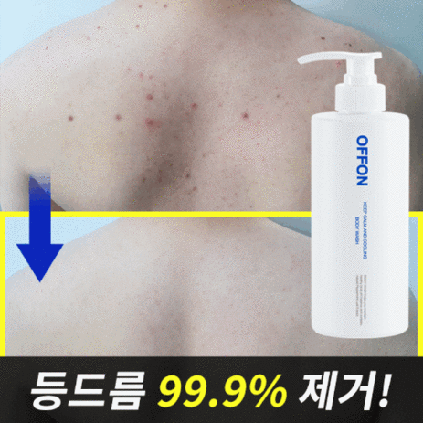 오프온-바디워시-(등드름-가드름-완화-식약처인증)-3+1증정(워시3개+루파스펀지-1개증정)-추천-상품