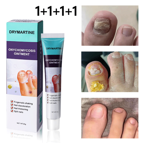 DRYMARTINE 무좀 연고 발톱무좀 발 관리 연고, 4개, 20ml