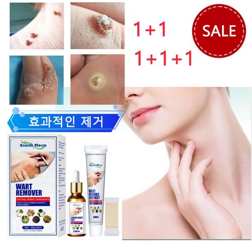 [국내배송] 1+1 피부 제거액 몸 얼굴 치료 문제 복원 크림, 1세트