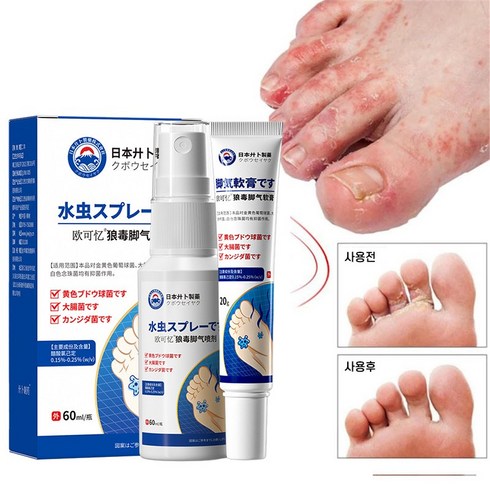 BT 발톱 무좀 발가락 무좀 완화 발냄새 제거 무좀 치료 세트, 1개, 60ml+20g