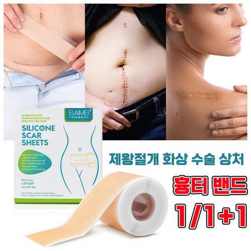 방수겔밴드 - [빠른배송] 흉터 밴드 제왕절개흉터 화상 수술 상처 흉터 제거 실리콘 젤 패치, 1개, 1개입