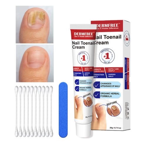 dermfree 리페어 크림 - DERMFREE 발톱 무좀 손발톱 케어 크림 풋 리페어 크림, 21g, 4개