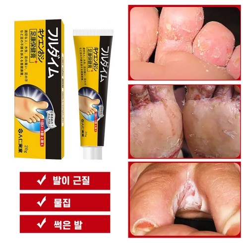 BT 발톱무좀 연고 무좀약 연고 발냄새 제거 발각질제거 연고, 2개, 20g