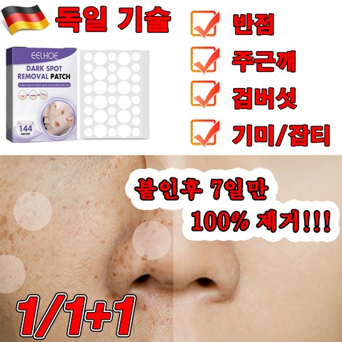 멜라샷 - 1/1+1/2+2 기미 패치 잡티 주근깨 제거 패치 색소침착 착색 멜라토닝 패치 단 7일만에 미백 개선, 1개, 144매입