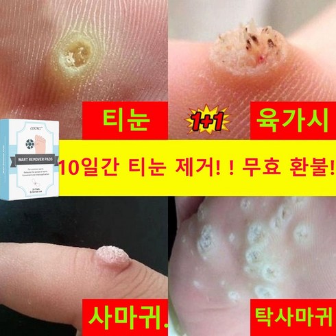 티눈밴드 - [국내배송] 티눈 밴드 티눈제거 밴드 보호테이프 발바닥 통증 풋케어, 4개