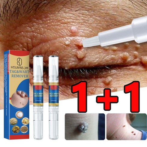 1+1 치료 제거연고 제거 스킨 제거 제거 크림, 1개, 3ml