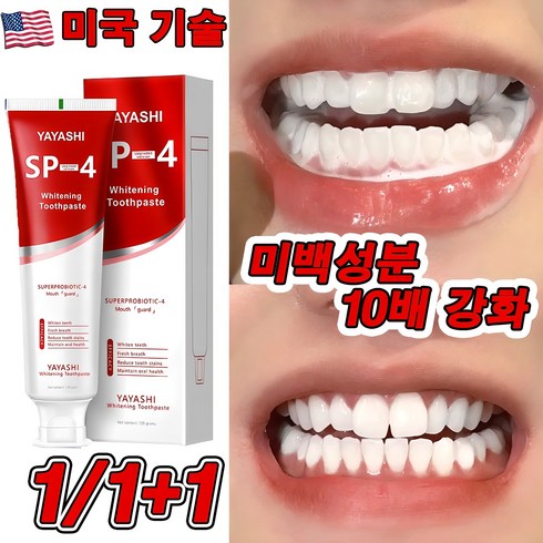 독일아조나치약 - 미국 SP4 1+1/2+2 고불소 미백 치약 프로바이오틱 치약 화이트닝 잇몸붓기 염증 예방 구취케어 치약, 1개, 120g