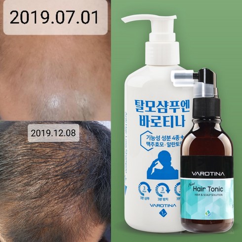 2023년 가성비 최고 최대용량특집전 현대약품 마이녹셀 탈모샴푸 더블세트 - 바이오틴 탈모샴푸 탈모영양제 두피탈모케어 세트 M탈모 정수리탈모 4중기능성 임상완료 뉴헤어토닉+기능성 탈모샴푸엔바로티나