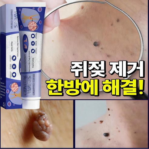 [국내배송] 1+1/2+2 미국 피부 치료 제거 연고 신속하고 효과적인 제거 스킨 제거 크림, 2개(1+1), 1개