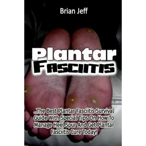 Plantar Fasciitis: The Best Plantar Fasciitis Survival Guide with Special Tips O Paperback, Createspace Independent Publishing Platform