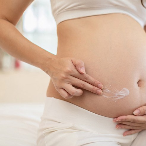 끈적임 없이 촉촉한 일리윤 튼살크림, 튼살 고민 이제 안녕!