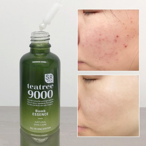 에스알픽 트러블 자국 보습 모공수축 티트리폭탄 에센스 50ml, 1개