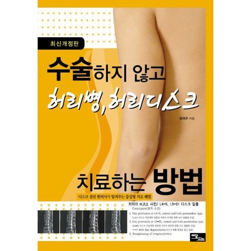 수술하지 않고 허리병 허리디스크 치료하는 방법 (큰글자도서), 정재우 저, 이담북스(이담Books)