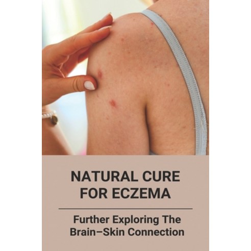 Natural Cure For Eczema: Further Exploring The Brain-Skin Connection: What Causes Eczema Paperback, Independently Published, English, 9798740432663