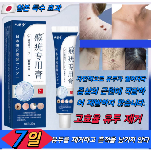 QQ19, 통증과 흉터 없이 매끈한 피부를 되찾아주는 섬세한 사마귀 제거 솔루션