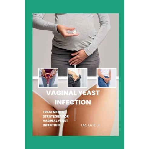 (영문도서) Vaginal Yeast Infection: Treatments Strategies for Vaginal Yeast Infection Paperback, Independently Published, English, 9798884337916