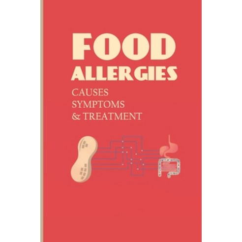 Food Allergies: Causes Symptoms & Treatment: Uncommon Food Allergies Paperback, Independently Published, English, 9798743440221