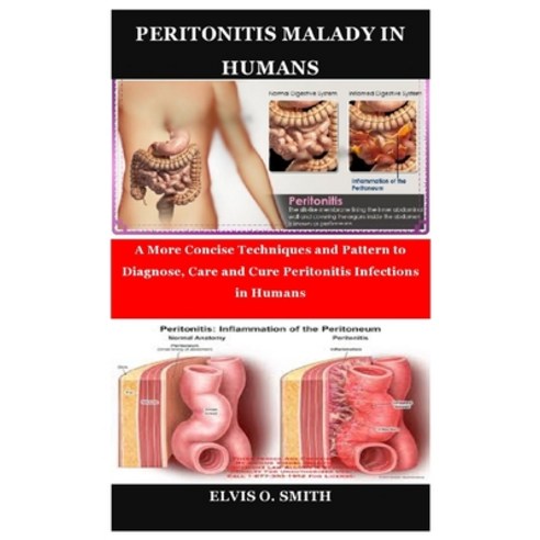 Peritonitis Malady in Humans: A More Concise Techniques and Pattern to Diagnose Care and Cure Perit... Paperback, Independently Published, English, 9798746491756