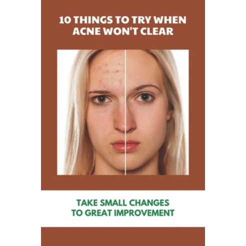 10 Things To Try When Acne Won''t Clear: Take Small Changes To Great Improvement: Holistic Ways To El... Paperback, Independently Published, English, 9798740168111
