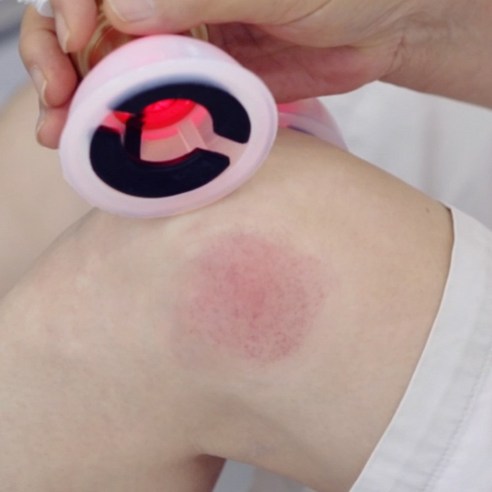 지친 일상에 활력을, 히미나 개인용 저주파 자극기