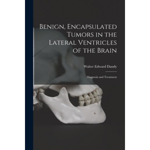 (영문도서) Benign Encapsulated Tumors in the Lateral Ventricles of the Brain: Diagnosis and Treatment Paperback, Hassell Street Press, English, 9781014871473