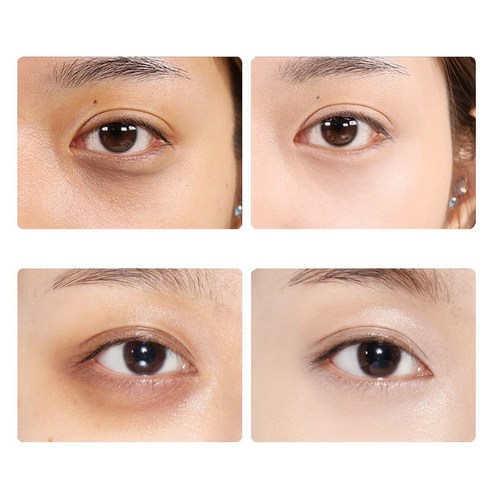 눈밑 문제 해결의 만병통치약