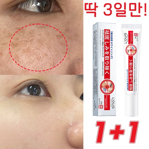 일본 1/1+1 주근깨 제거 크림 기미 잡티 검버섯 제거 미백 크림 피부 개선 20g, 1+1+1(3개), 1개