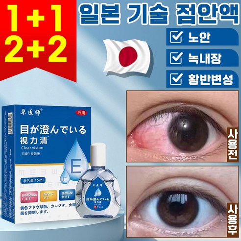 [빠른배송] 일본 점안액 안구건조증 안약 노안 완화 눈피로 해소 황반변성 시력교정 아이케어, 14.9ml, 2개