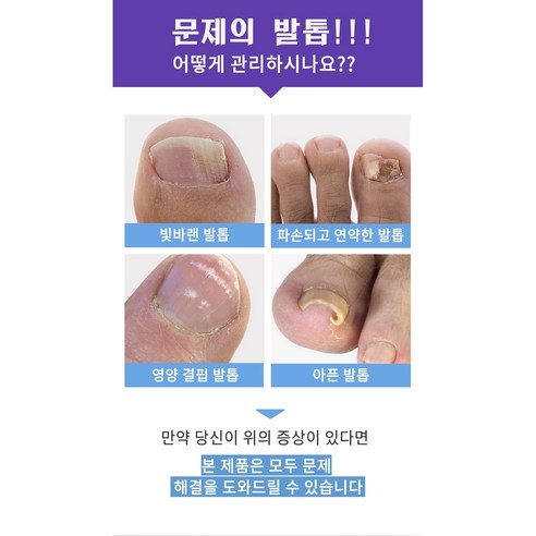 효율적인 발톱 관리의 동반자