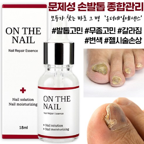 비비룩 온더네일 에센스, 18ml, 1개