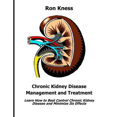 Chronic Kidney Disease Management and Treatment: Learn How to Best Control Chronic Kidney Disease an... Paperback, Independently Published, English, 9798729275380