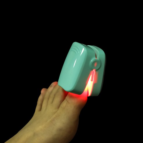 세레이오 손발톱 레이저로 숨기고 싶었던 발톱, 이제 당당하게!