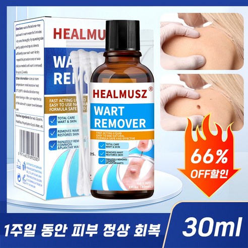 [국내배송]HEALMUSZ 편평 제거 사마귀제거제 피부 요철 복구 피부 관리 에센스 피부 라벨 제거, 1개, 30ml