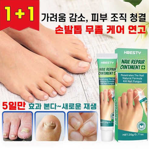 [국내배송] 발톱 연고 손톱 치료제 네일 케어 진균 리페어 크림 포장증정, 20g, 2개, 1개입