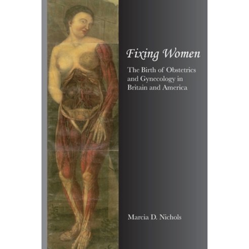 Fixing Women: The Birth of Obstetrics and Gynecology in Britain and America Paperback, University of California Me..., English, 9781735542300