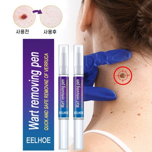 피부를 완벽하게 케어해주는 얼굴 제거제, 바디태그 제거제, 그리고 피부치료