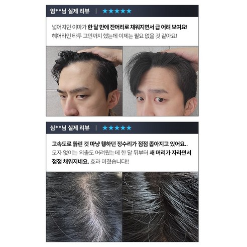 피쿠스의 생명력으로 두피에 활력을, 트리코닉스 트리코엑스 두피 피쿠스 앰플