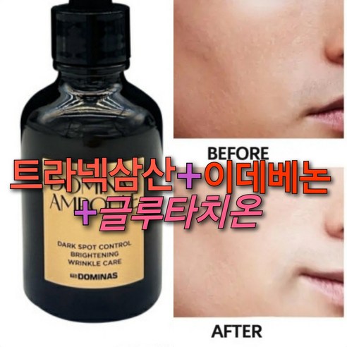 검고진한기미 첫단계기미앰플/트라넥삼산+이데베논+글루타치온, 1개, 50ml