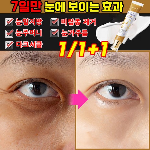 [빠른배송] 1+1/2+2 미국기술 눈 밑지방 비립종 제거 팔자 주름 목주름 눈밑주름 개선 크림, 2개, 30g