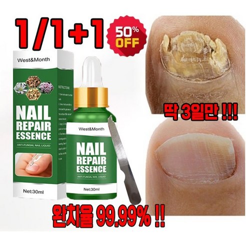 1+1세트 발톱 무좀 에센스 네일 치료 손발톱 무좀 완화 영양제 포장증정, C, 4개, 30ml
