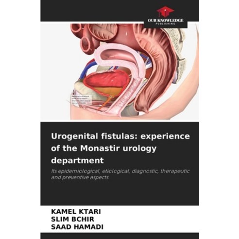 (영문도서) Urogenital fistulas: experience of the Monastir urology department Paperback, Our Knowledge Publishing, English, 9786206521136