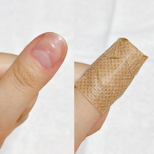 밤 사이 피부에 불어넣는 탄력 에너지, 케라셀 나이트타임 패치