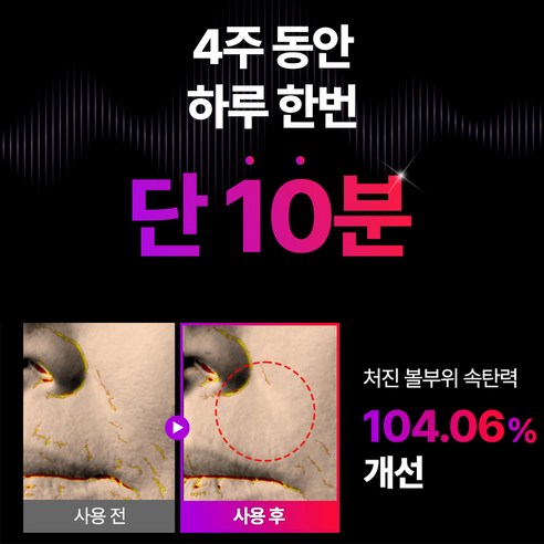 아름다움을 깨우는 섬세한 터치, 마미케어 브이쎄라 핸디형 마사지기