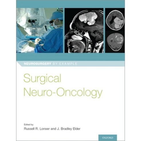 Surgical Neuro-Oncology Paperback, Oxford University Press, USA, English, 9780190696696